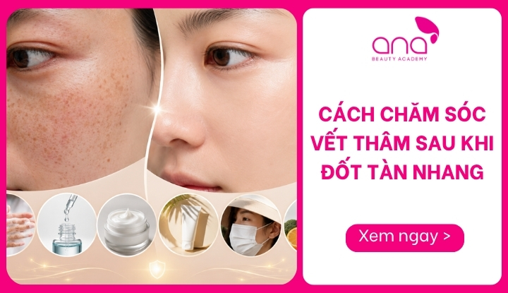 cách chăm sóc vết thâm sau khi đốt tàn nhang