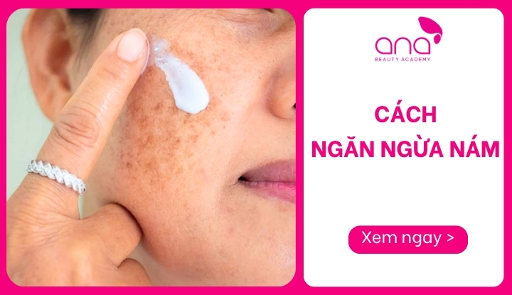 cách ngăn ngừa nám