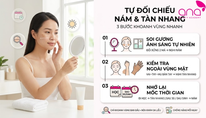 Cách phân biệt nám và tàn nhang tại nhà qua 3 bước