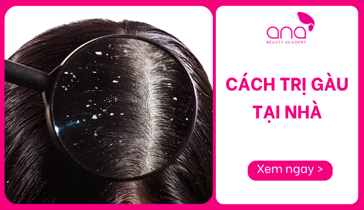 cách trị gàu tại nhà
