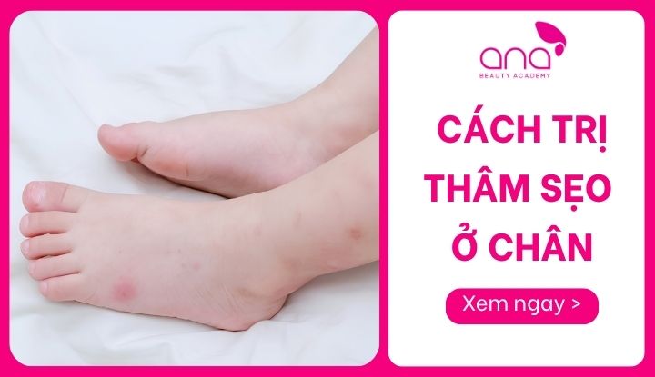 cách trị thâm sẹo ở chân
