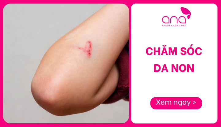 chăm sóc da non