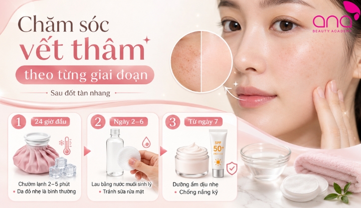 Cách chăm sóc vết thâm theo từng giai đoạn sau đốt tàn nhang