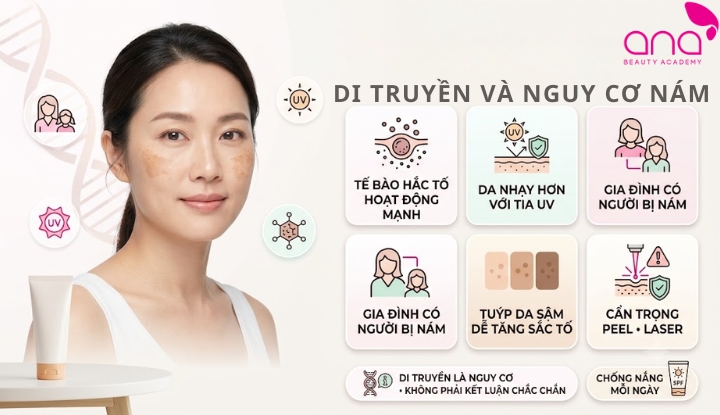 Cơ địa di truyền ảnh hưởng đến nguy cơ bị nám