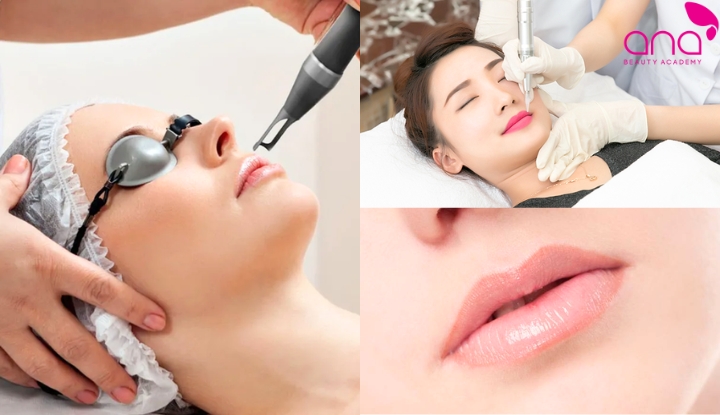 Điều trị thâm mép miệng bằng công nghệ cao