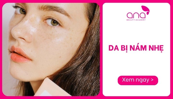 da bị nám nhẹ