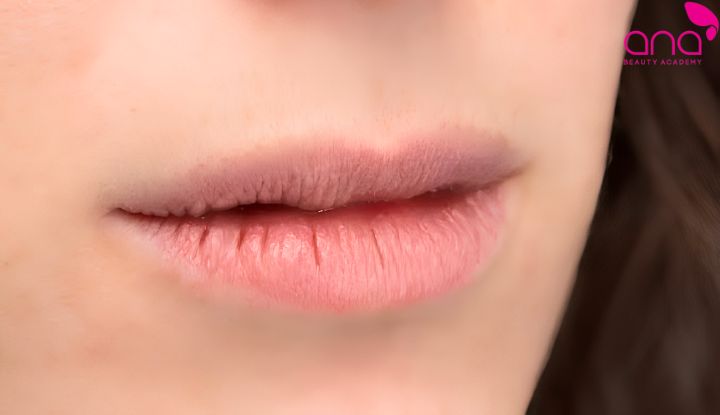 Da non sau bong vảy dễ khô ráp, sần và xuất hiện các đường nứt nhỏ (Nguồn: Internet)