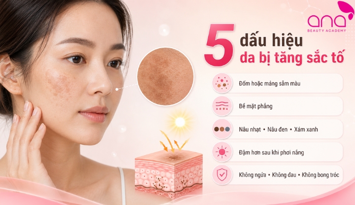 Da xuất hiện đốm phẳng, sẫm màu hơn vùng xung quanh