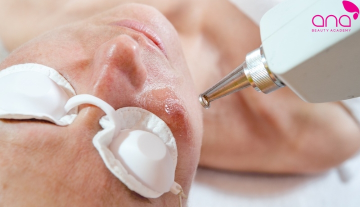 Điều trị giãn mao mạch