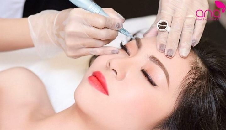 Hút mực chân mày là gì và có hết không?