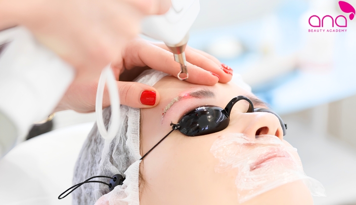 Hút mực chân mày bằng laser