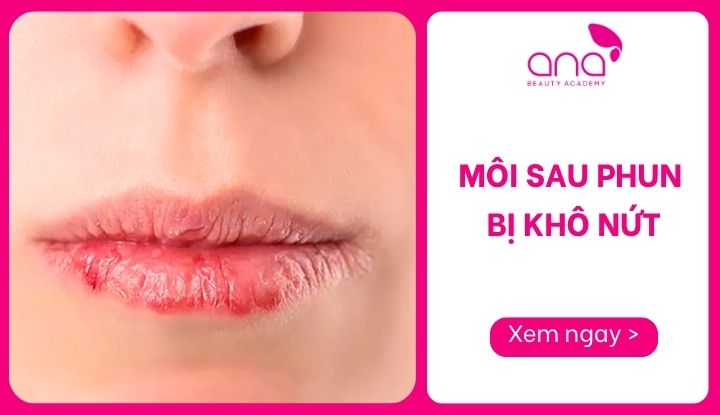 môi sau phun bị khô nứt