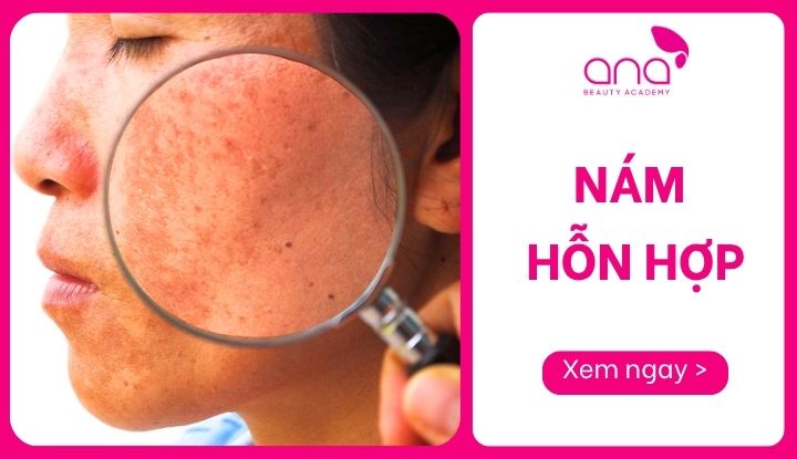 Nám hỗn hợp