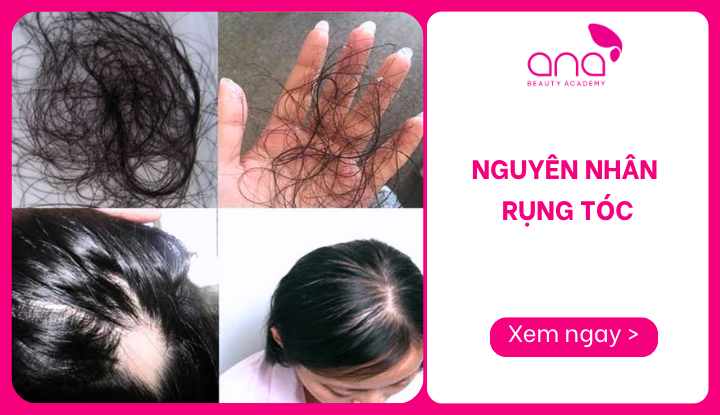 nguyên nhân rụng tóc