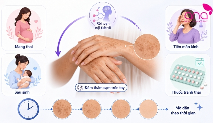 Nội tiết rối loạn gây thâm da tay