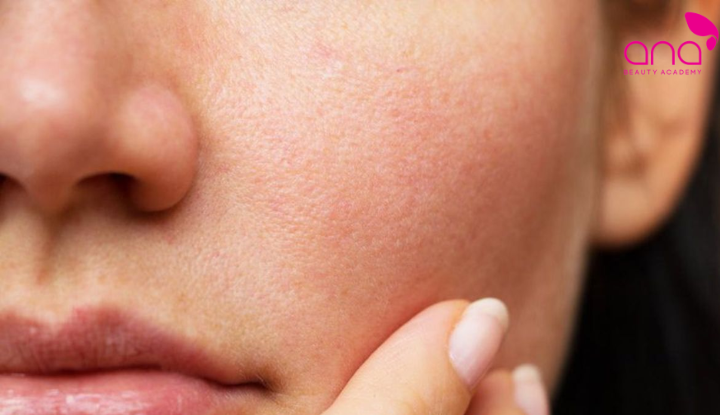 Phân biệt các loại da và da khô  (Nguồn: Internet)