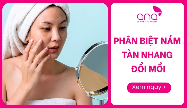 Phân biệt nám tàn nhang đồi mồi