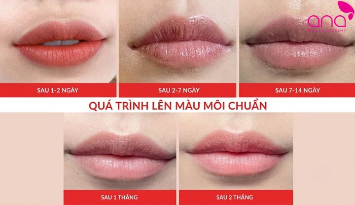 Quá trình lên màu sau khi xăm môi diễn ra qua nhiều giai đoạn (Nguồn: internet)