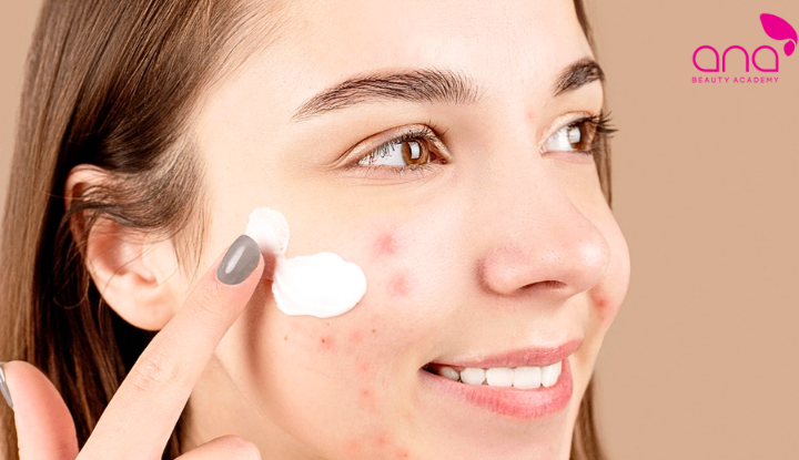 Skincare giúp kiểm soát dầu nhờn, bít tắc và mụn tuổi dậy thì (Nguồn: Internet)