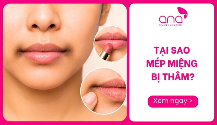 tại sao mép miệng bị thâm