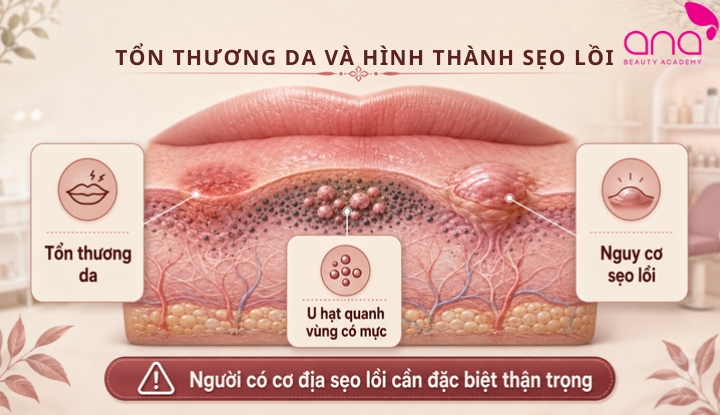 Tổn thương da và hình thành sẹo lồi