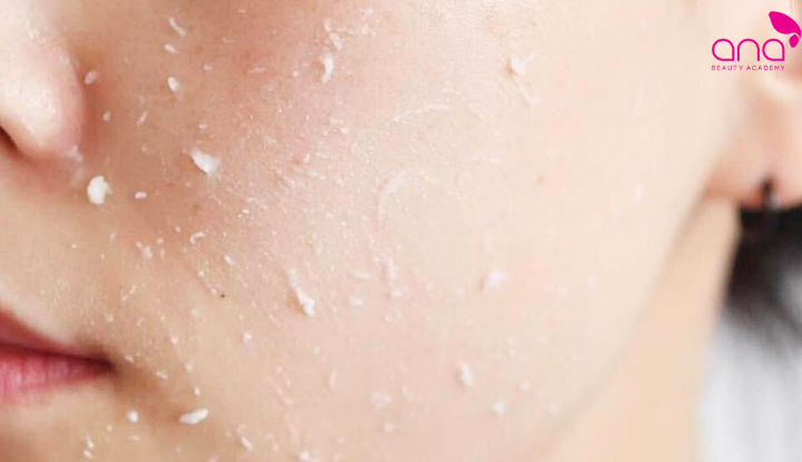 Tuổi dậy thì nên skincare như thế nào với tẩy tế bào chết