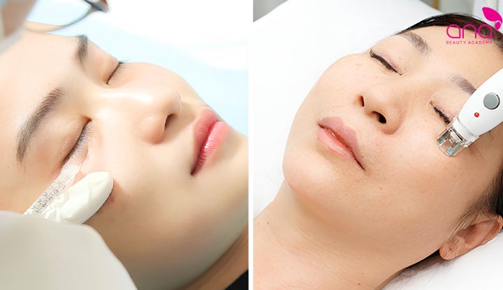 Vi kim kích thích tái tạo collagen vùng mắt (Nguồn: Internet)