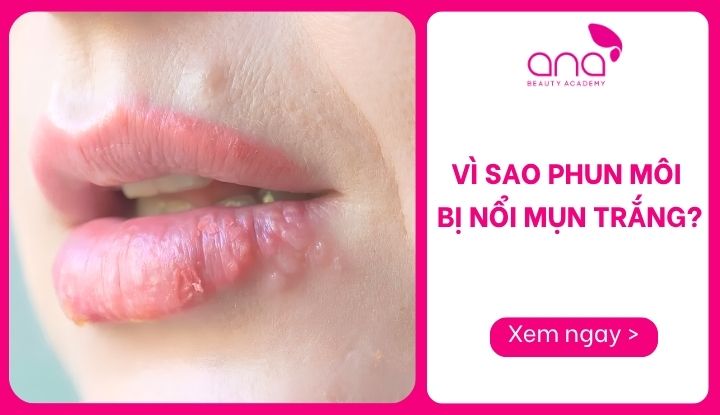 Vì sao phun môi bị nổi mụn trắng