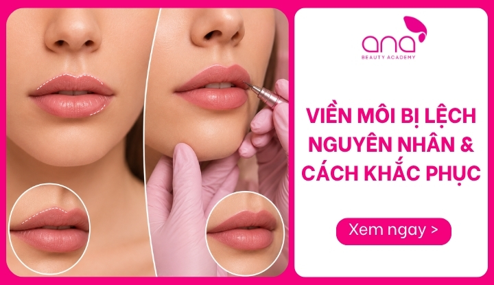 viền môi bị lệch