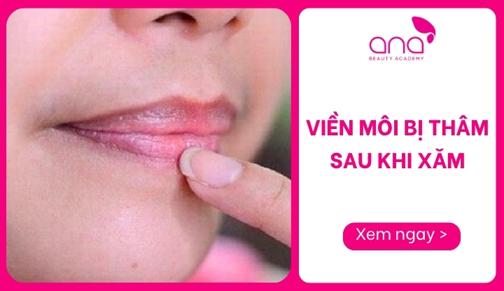 viền môi bị thâm sau khi xăm