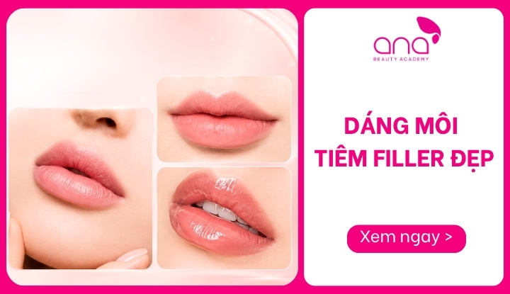 dáng môi tiêm filler đẹp