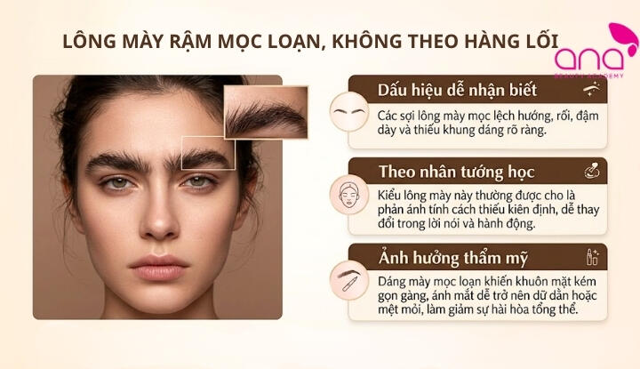 Lông mày rậm mọc loạn, không theo hàng lối