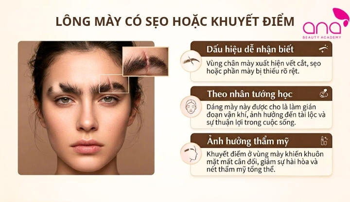 Lông mày có sẹo hoặc khuyết điểm