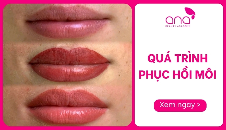 Quá trình phục hồi môi