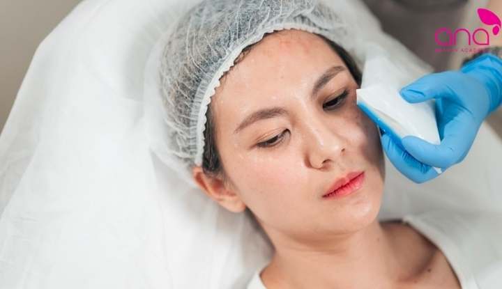Cách xử lý filler bị cứng nhẹ ngay tại nhà