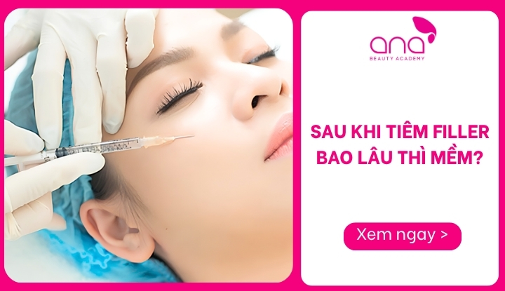 Sau khi tiêm filler bao lâu thì mềm