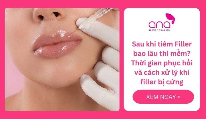 sau khi tiêm filler bao lâu thì mềm