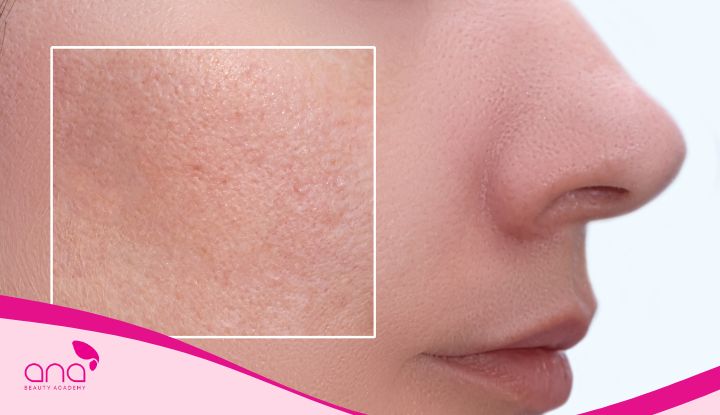 Cách xác định loại da bằng lỗ chân lông