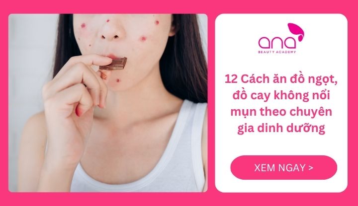 Cách ăn đồ ngọt đồ cay không nổi mụn