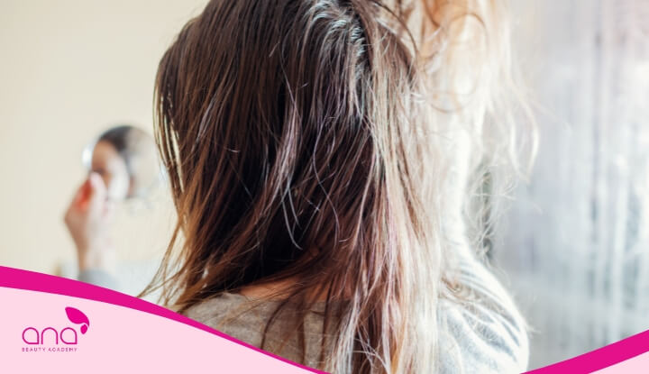 Da tiết nhiều dầu khiến mái tóc luôn trong tình trạng bóng nhờn, bết dính