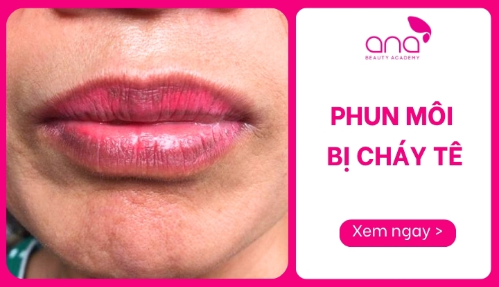 phun môi bị cháy tê
