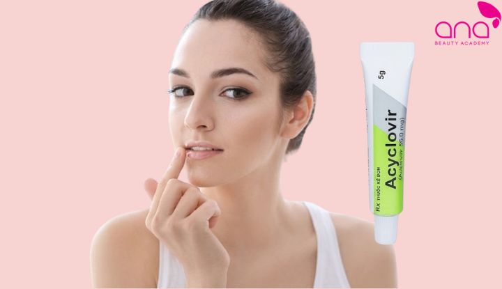 Bôi acyclovir sau phun môi kháng virus hỗ trợ môi phục hồi nhanh (Nguồn: Internet)