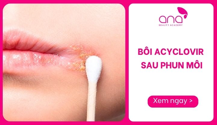 bôi acyclovir sau phun môi