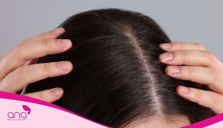 Không nên gội đầu bằng nước vỏ bưởi nếu da đầu đang bị nấm, viêm nhiễm nặng  