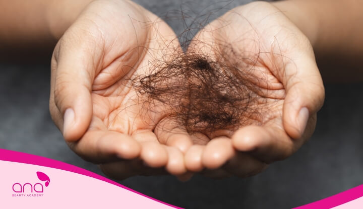  Tình trạng rụng tóc chỉ đáng báo động khi số tóc rụng mỗi ngày nhiều hơn 100 sợi 