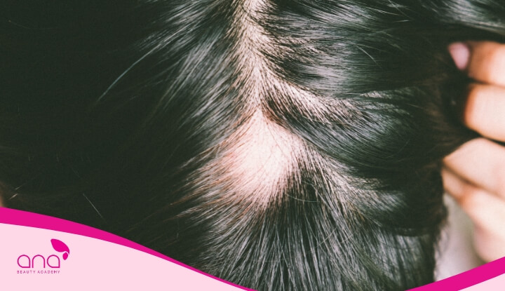 Rụng tóc là một quá trình sinh lý tự nhiên và hoàn toàn bình thường của cơ thể