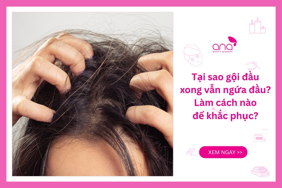 Tại sao gội đầu xong vẫn ngứa? Làm sao để khắc phục?