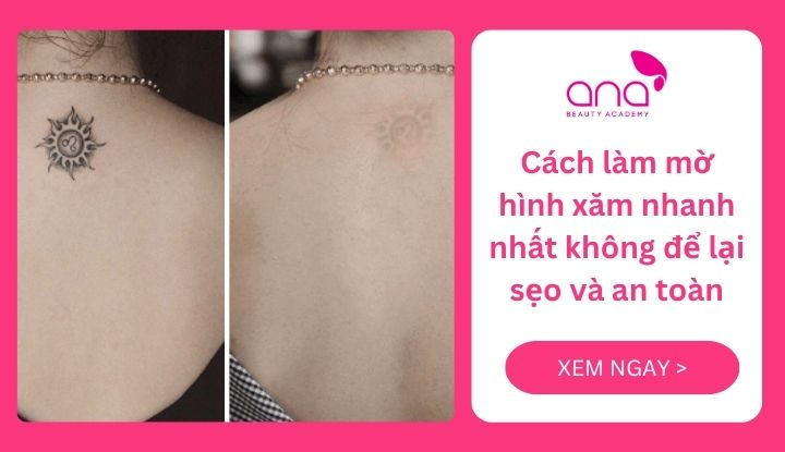 Cách làm mờ hình xăm nhanh nhất