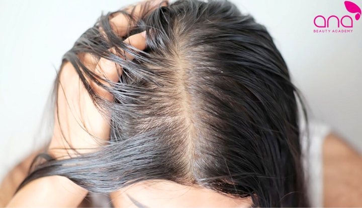 Da đầu tiết nhiều dầu