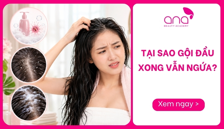 tại sao gội đầu xong vẫn ngứa